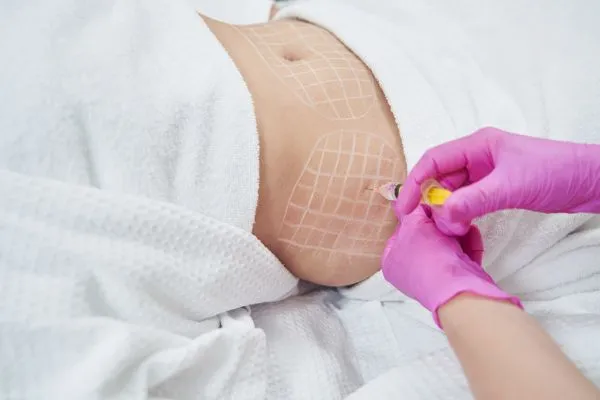 image of fat dissolving injections on love handles to help combat weight gain Pollokshields