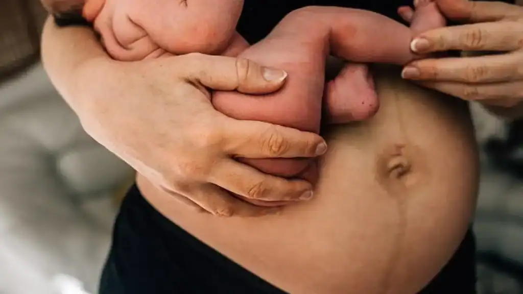 Why Is My Stomach Still Big After Pregnancy Pollokshields?